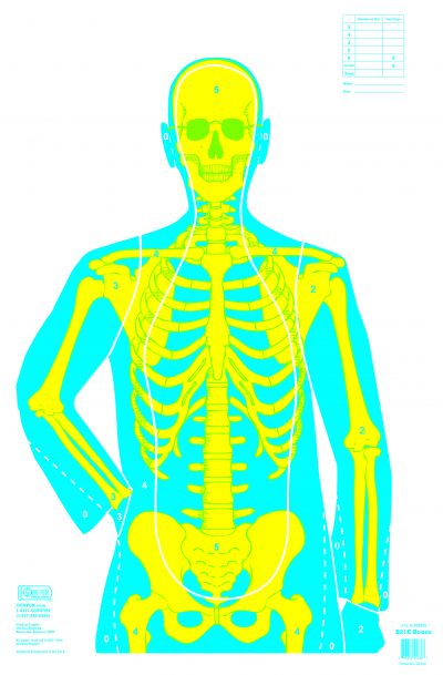B21E - Bones (22340)